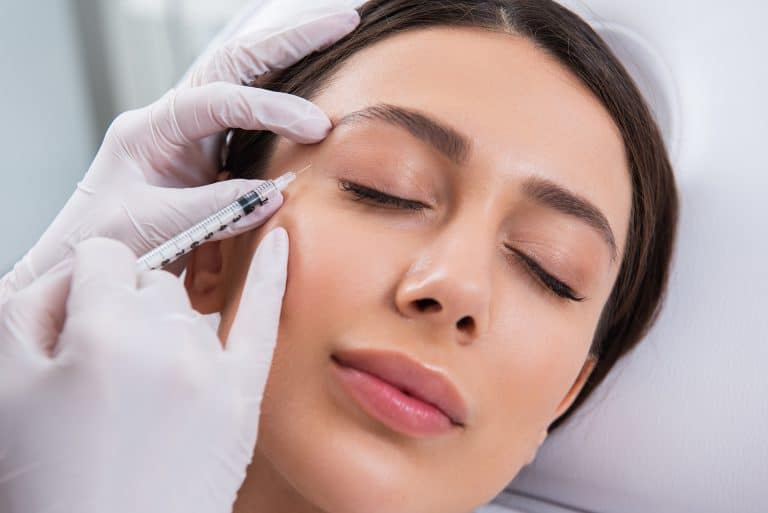 Botox Improves Crow’s Feet Lines