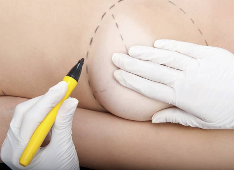 What Are The Safest Plastic Surgery Options?
