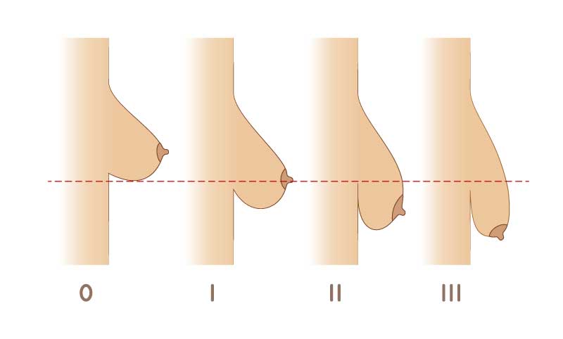 Chest Enhancement