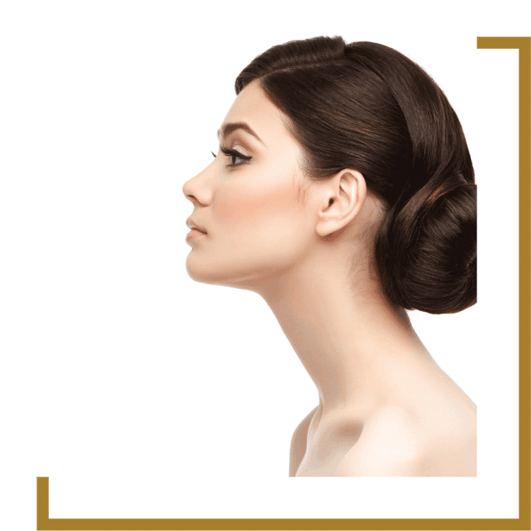 Placement of Facial Compression Garment Marena Facelift Chin Liposuction  Kybella, Board Certified Plastic Surgeon Located In Newport Beach, CA