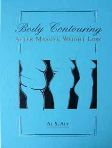 Body Contouring After Massive Weight Loss book cover