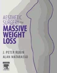 Aesthetic Surgery After Massive Weight Loss book cover
