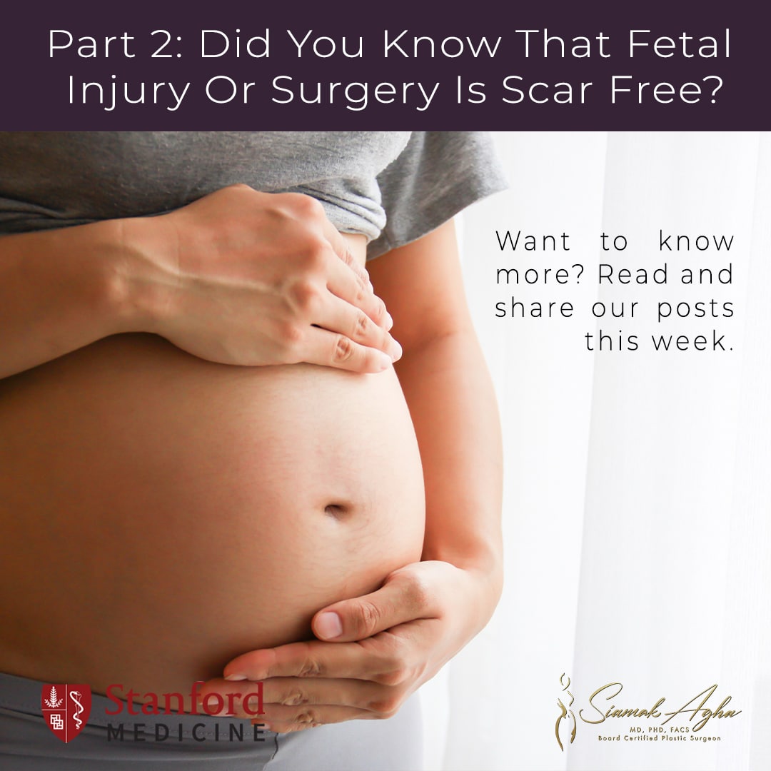 Did You Know That Fetal Injury or Surgery Is Scar Free?