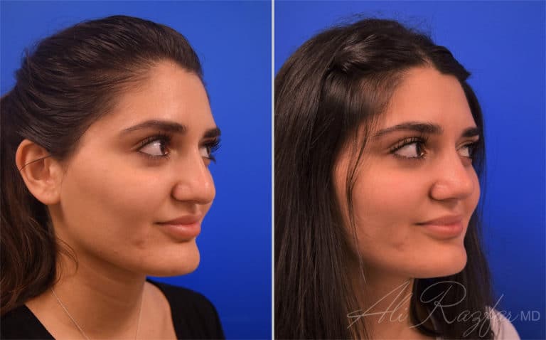 Face Procedures Before and After Photo Gallery