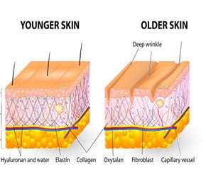 Skin Laxity After Weight Loss