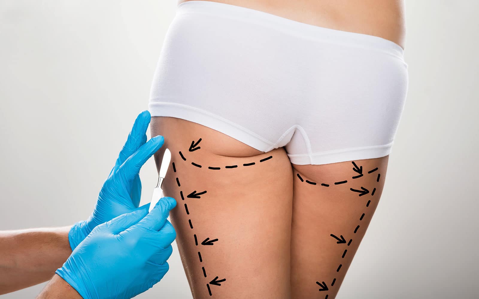 Will We Have Scarless Surgeries In The Future Newport Beach, CA