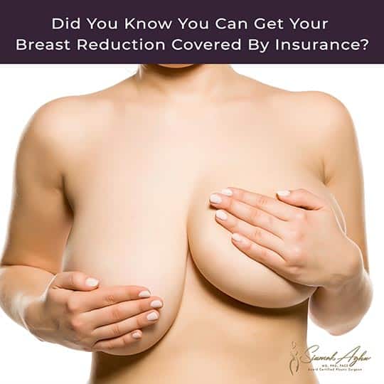 Did You Know that You Can Get Your Breast Reduction Covered by Insurance? Instagram Post