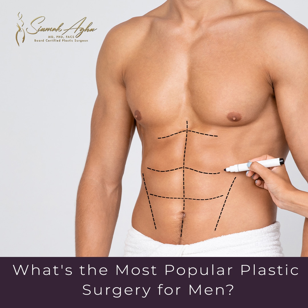 What Is The Most Popular Plastic Surgery for Men - Instagram Post Image