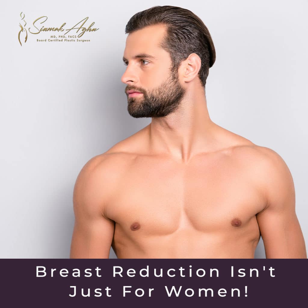 Did you know that breast reduction isn't just for women? - Instagram Post - Shirtless man