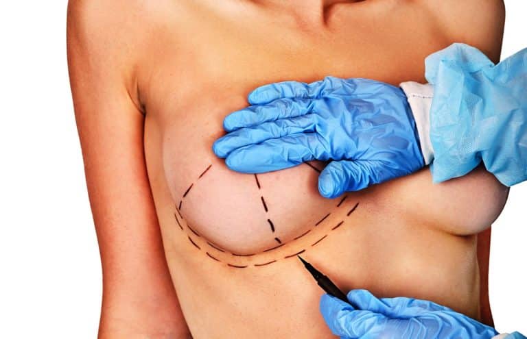 Can you guess when the first successful breast augmentation surgery was performed?