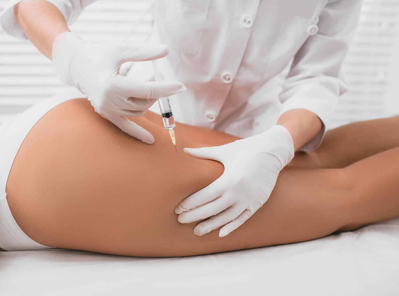 Got Cellulite? These treatment can work for you! Newport Beach, CA