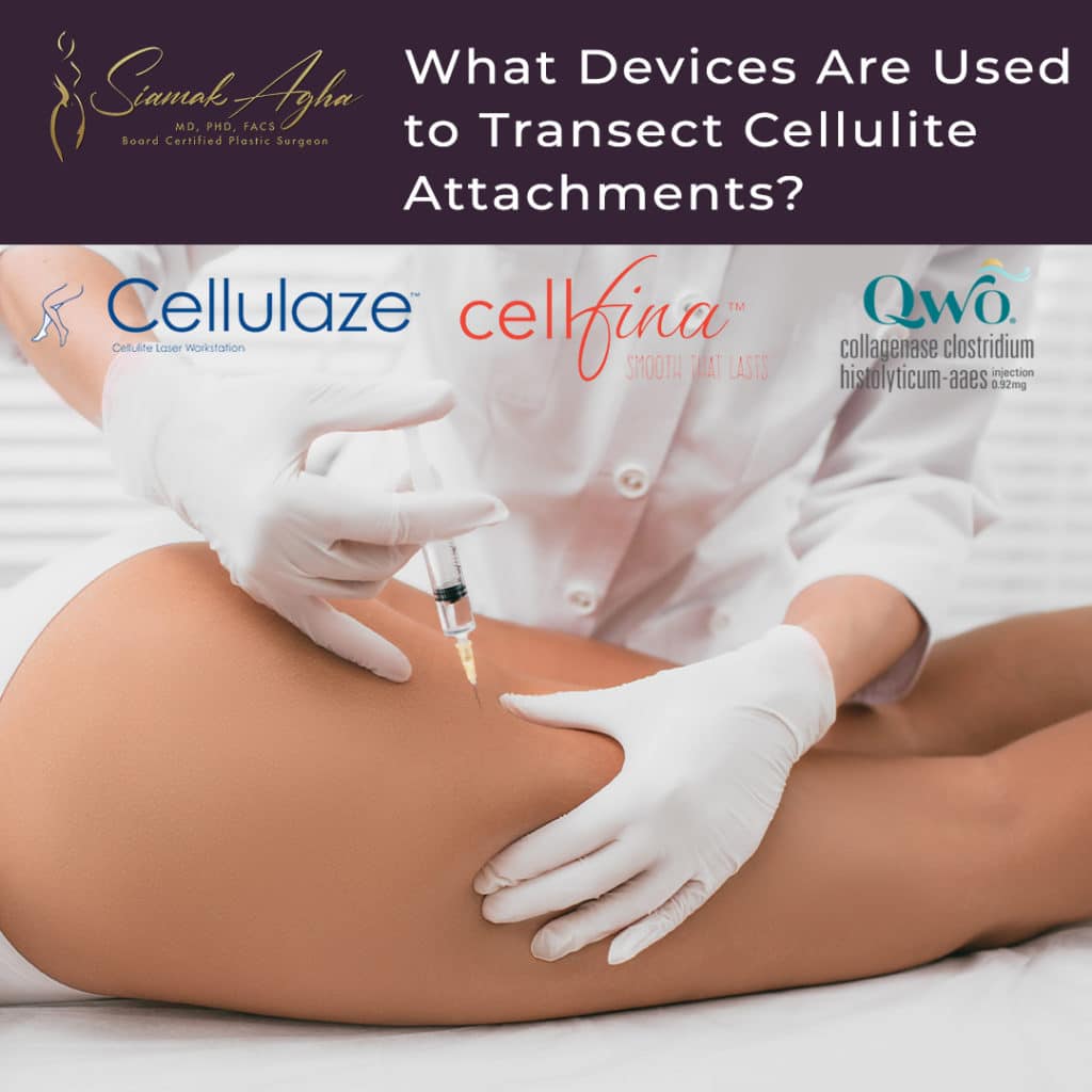 Cellulite treatment devices - Instagram Posts - medical professional injecting solution in women's thigh