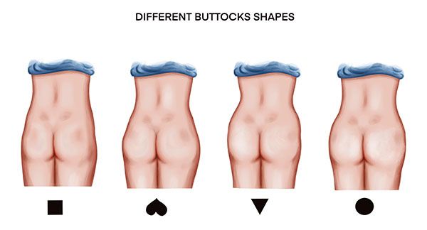 Buttock augmentation and reshaping with own fat tissue - Aesthetic