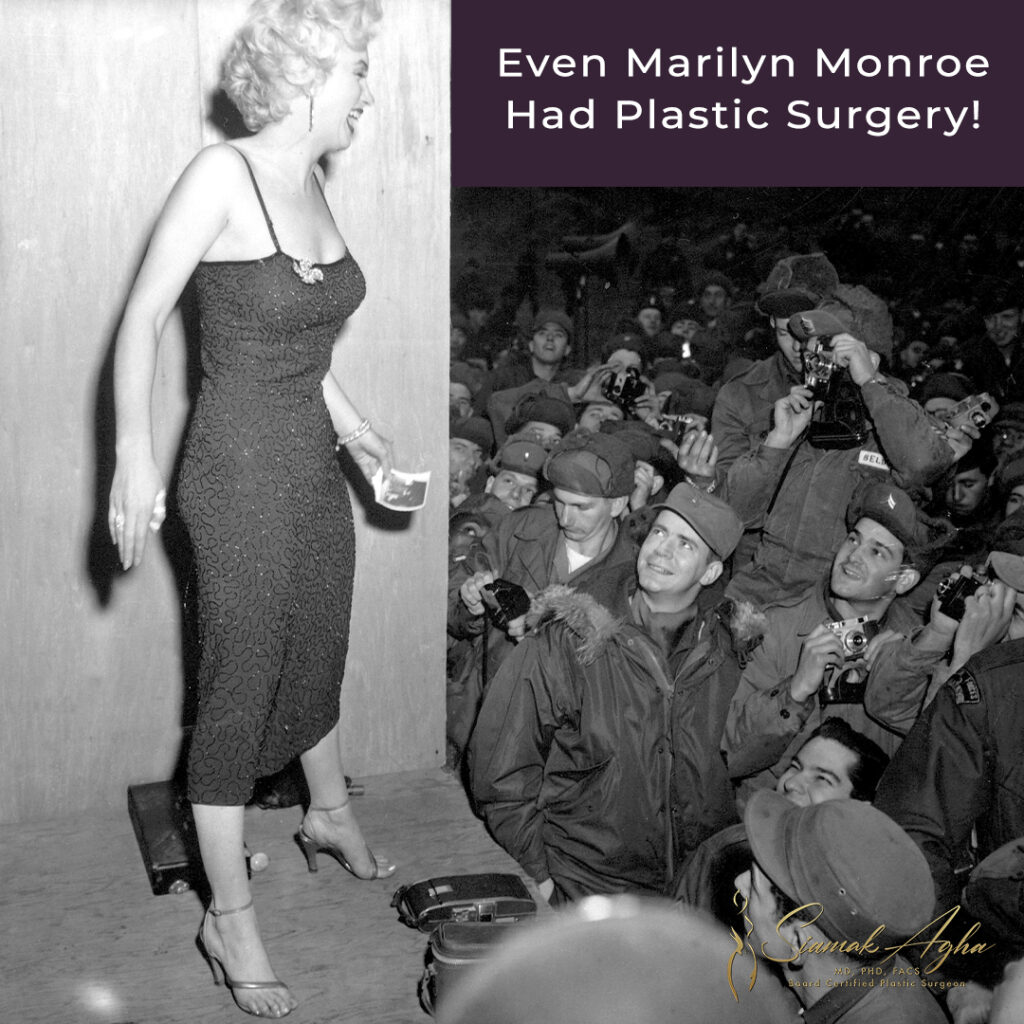 Marilyn Monroe had plastic surgery!