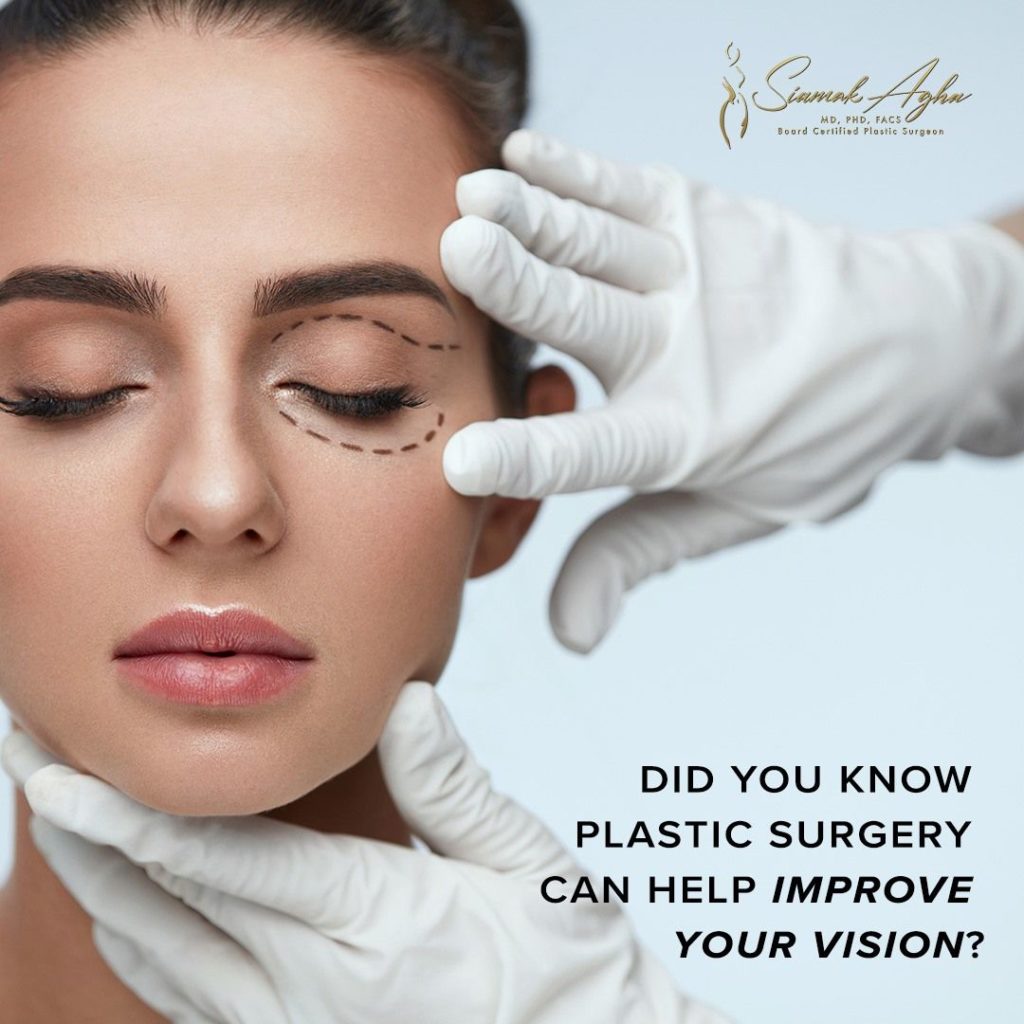 Did you know that plastic surgery can improve your vision?