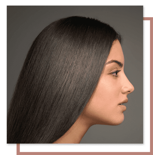 Rhinoplasty Newport Beach, CA