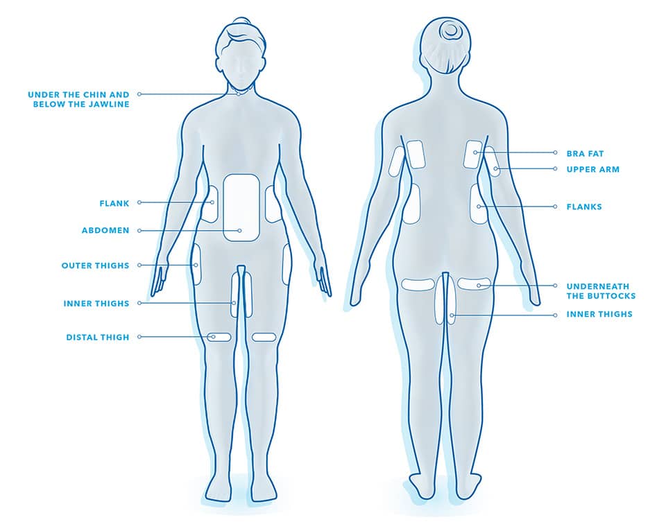 Banana Rolls & Muffin Tops: All the Areas CoolSculpting® Treats